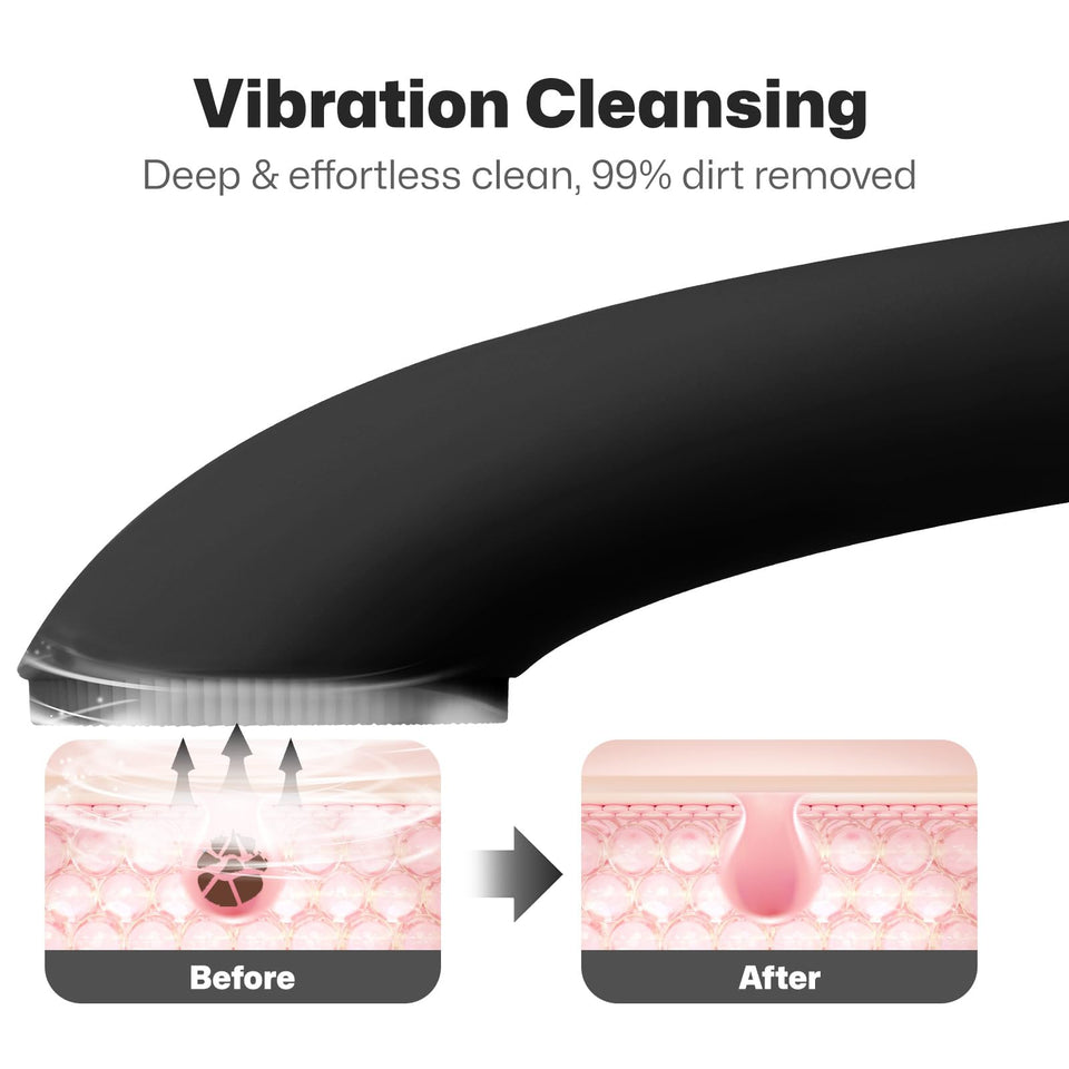 PRITECH Facial Cleansing Brush with Silicone Face Scrubber and Heat Massage for Deep Skin Cleaning