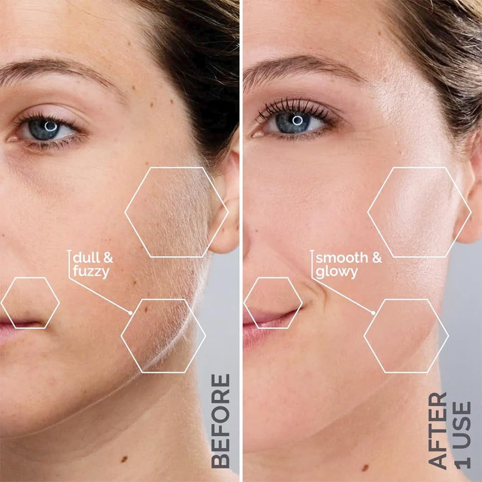 Michael Todd Beauty Sonicsmooth Dermaplaning Razor Women Face Eyebrow Trimmer Peach Fuzz Remover 8 Weeks Blades Lavender