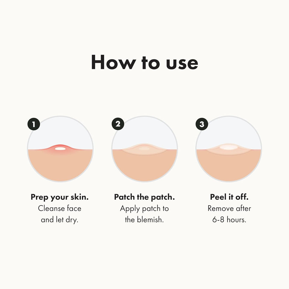 Mighty Patch Original Acne Pimple Patches by Hero Cosmetics Hydrocolloid Spot Stickers 36 Count