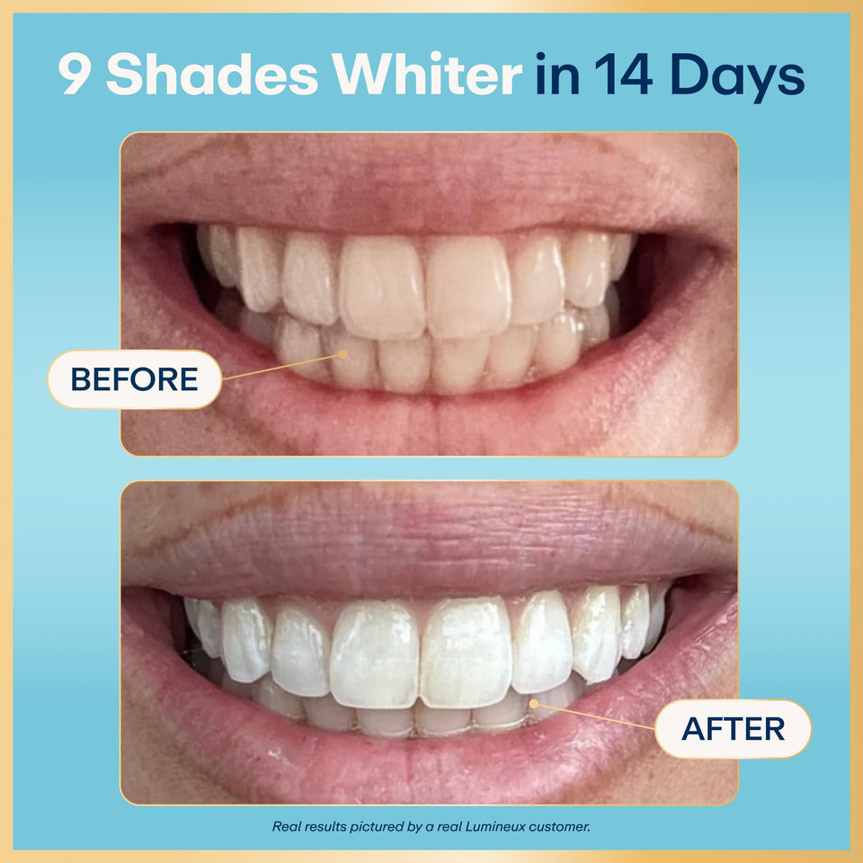 Lumineux Teeth Whitening Strips Kit Peroxide Free Formula for Whiter Teeth and Enamel Protection