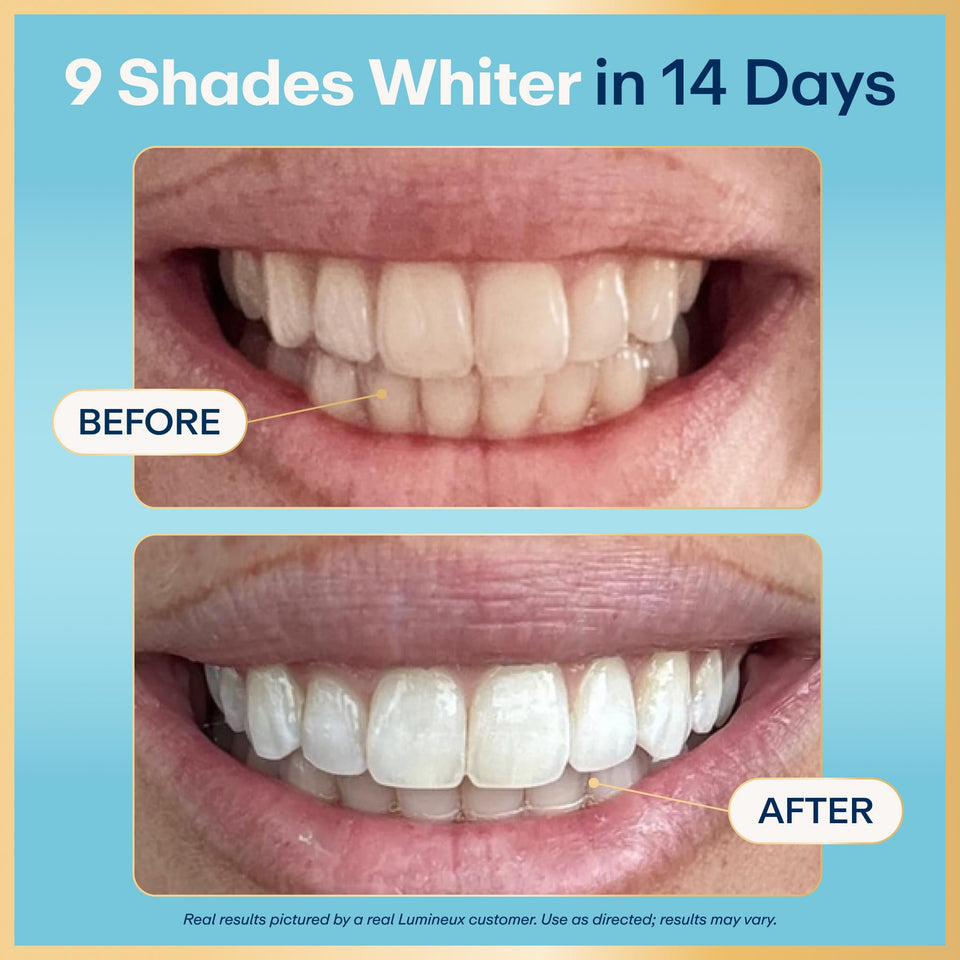 Lumineux Teeth Whitening Strips 21 Treatments 3 Months Peroxide Free Enamel Safe Sensitivity Free