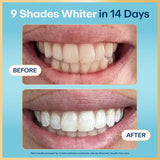 Lumineux Teeth Whitening Strips 21 Treatments 3 Months Peroxide Free Enamel Safe Sensitivity Free