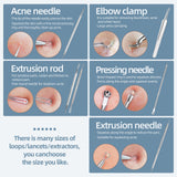 JPNK Blackhead Remover Comedone Extractor Acne Removal Kit Stainless Steel