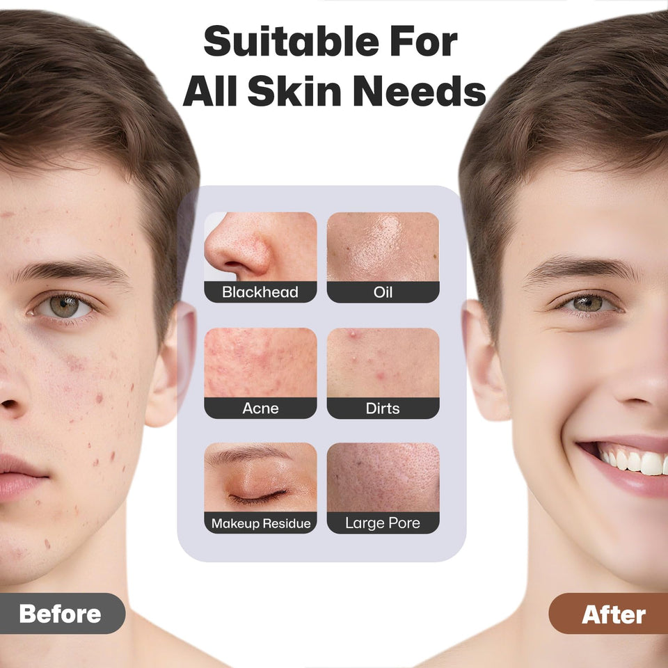 PRITECH Facial Cleansing Brush with Silicone Face Scrubber and Heat Massage for Deep Skin Cleaning