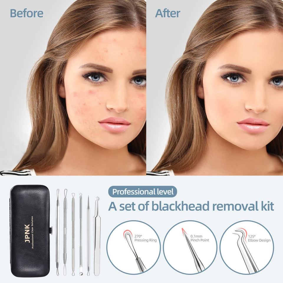 JPNK Blackhead Remover Comedone Extractor Acne Removal Kit Stainless Steel