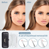 JPNK Blackhead Remover Comedone Extractor Acne Removal Kit Stainless Steel