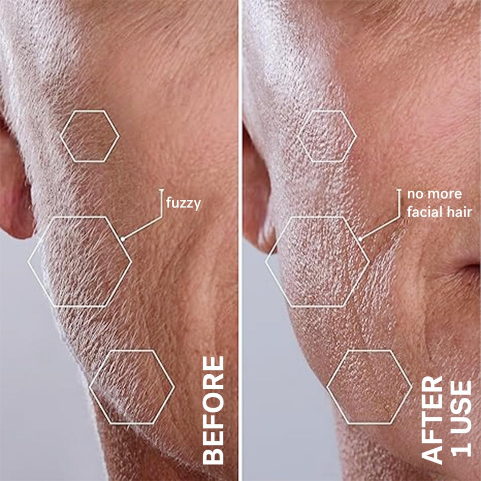 Michael Todd Beauty Sonicsmooth Dermaplaning Razor Women Face Eyebrow Trimmer Peach Fuzz Remover 8 Weeks Blades Lavender