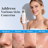 GUGUG Skin Scrubber Face Spatula 4 Modes Pore Cleaner Blackhead Remover Ultrasonic White