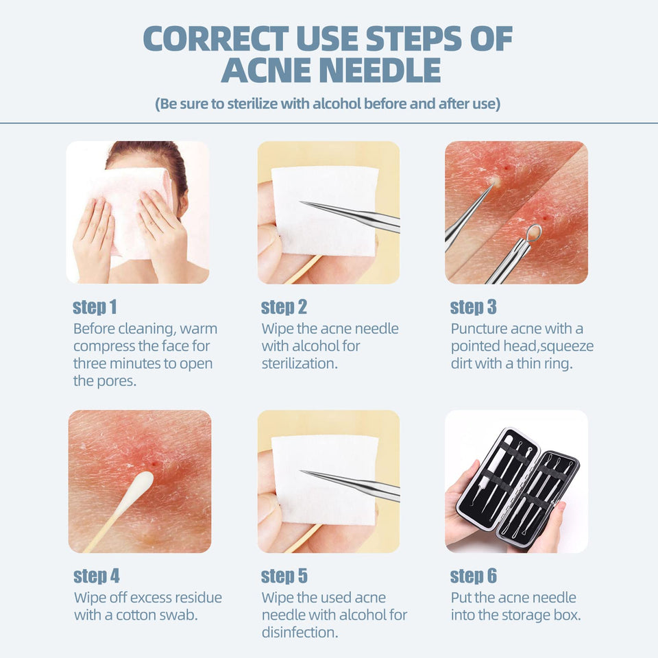 JPNK Blackhead Remover Comedone Extractor Acne Removal Kit Stainless Steel