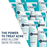 CeraVe Acne Foaming Cream Cleanser with 4% Benzoyl Peroxide Niacinamide & Ceramides Face Wash
