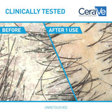 CeraVe Anti Dandruff Shampoo for Flake Removal Itchy Scalp Relief and Deep Hydration Care
