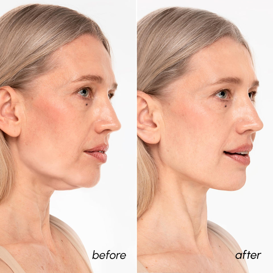 MAREE V Line Lifting Mask 24K Gold Collagen Jawline Shaper Retinol Hyaluronic Acid Neck Tightening