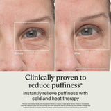 Therabody TheraFace Depuffing Wand Cold Heat Skincare Eye Massager Dark Circles Radiance White
