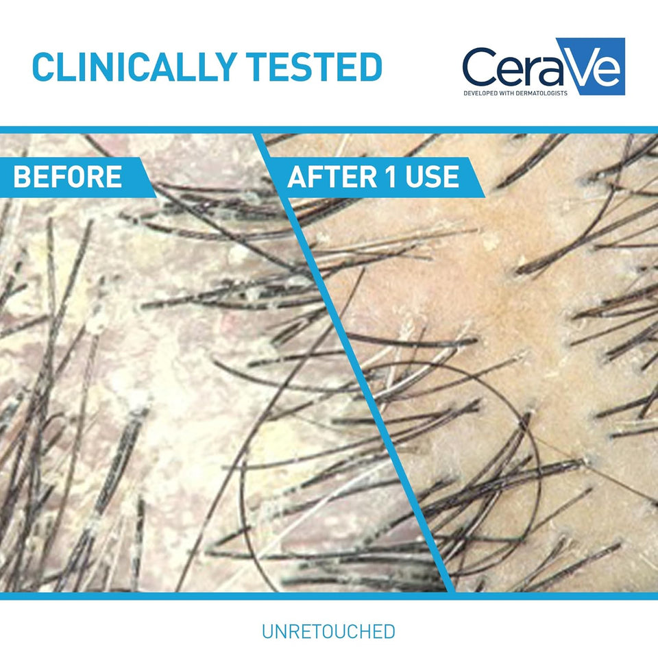 CeraVe Anti Dandruff Shampoo for Flake Removal Itchy Scalp Relief and Deep Hydration Care