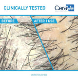 CeraVe Anti Dandruff Shampoo for Flake Removal Itchy Scalp Relief and Deep Hydration Care