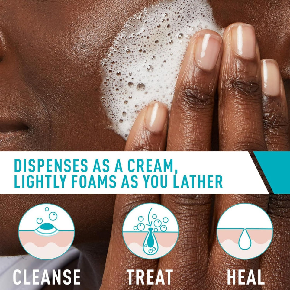 CeraVe Acne Foaming Cream Cleanser with 4% Benzoyl Peroxide Niacinamide & Ceramides Face Wash