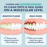 LIVFRESH Toothpaste Gel Clinically Proven for Better Plaque Removal and Improved Gum Health